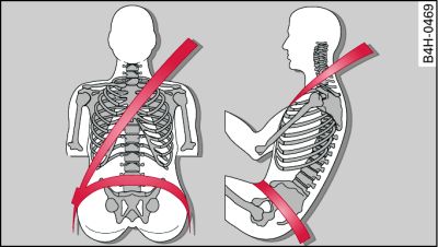 Positionnement de la sangle baudrier et de la sangle sous-abdominale